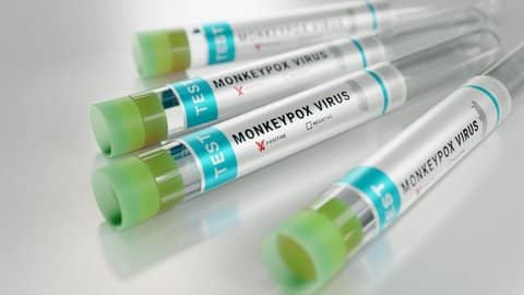 Four vials labeled "test monkeypox virus"